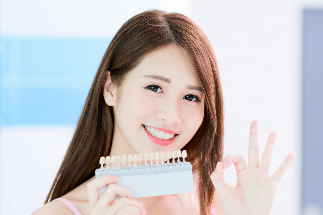 KDS-teeth-whitening