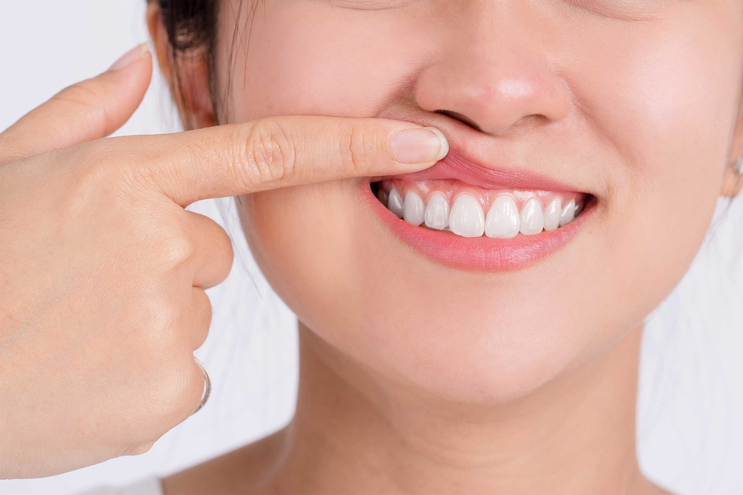 Smile Bright, Live Right: 5 Ways How Gum Disease Affects Your Health