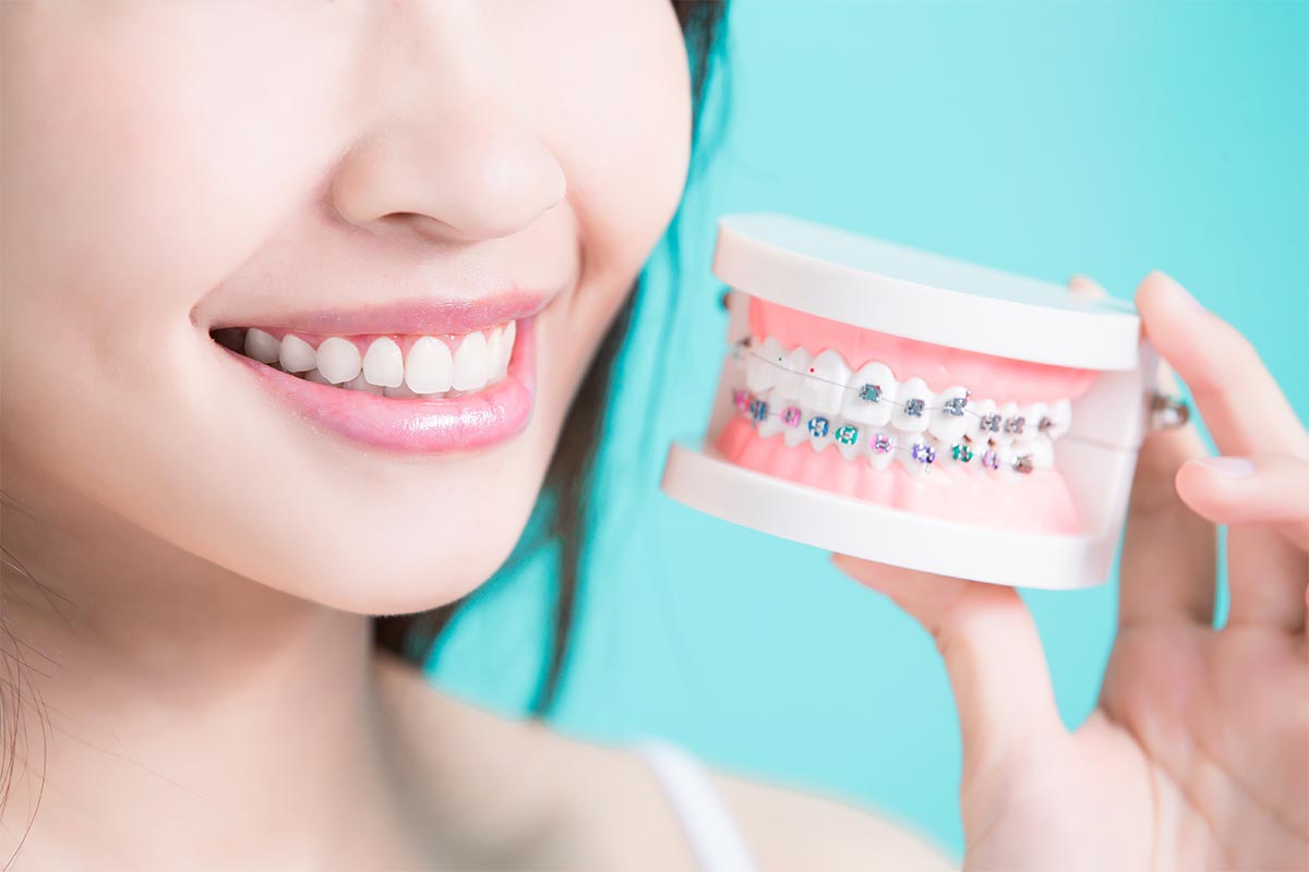 Dental Braces Treatment Singapore