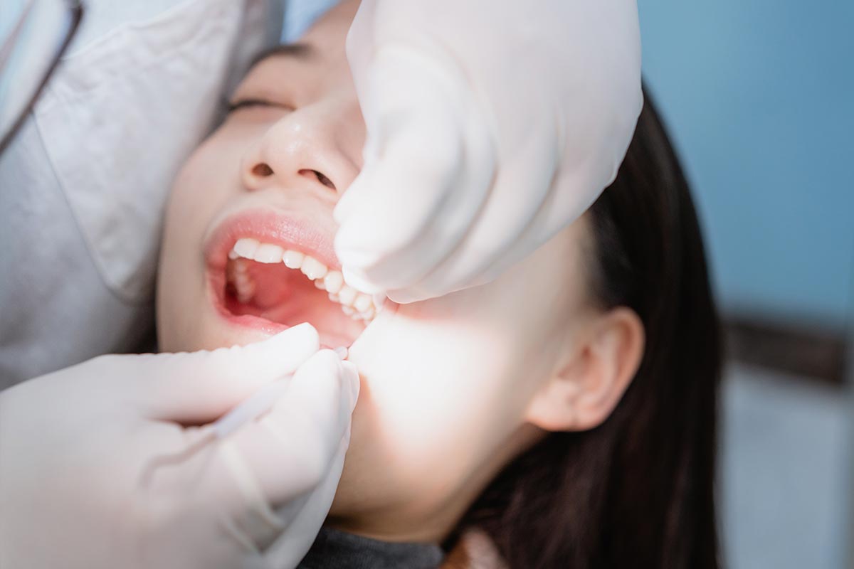 Treatment and Removal of-Wisdom Teeth