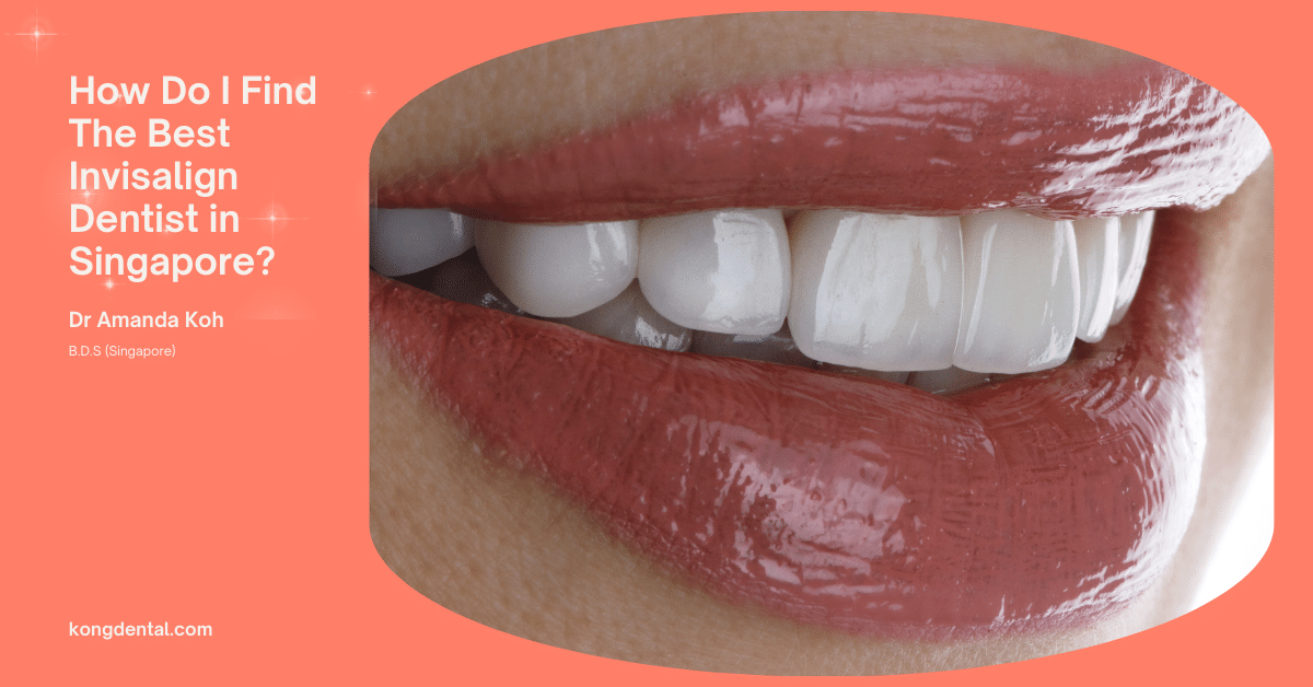 How Do I Find The Best Invisalign Dentist in Singapore?