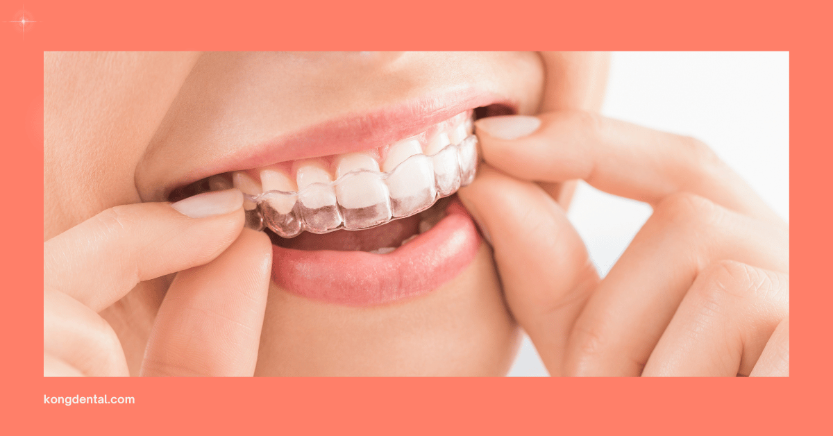 Invisalign for Straighter Teeth - Dr Amanda Koh