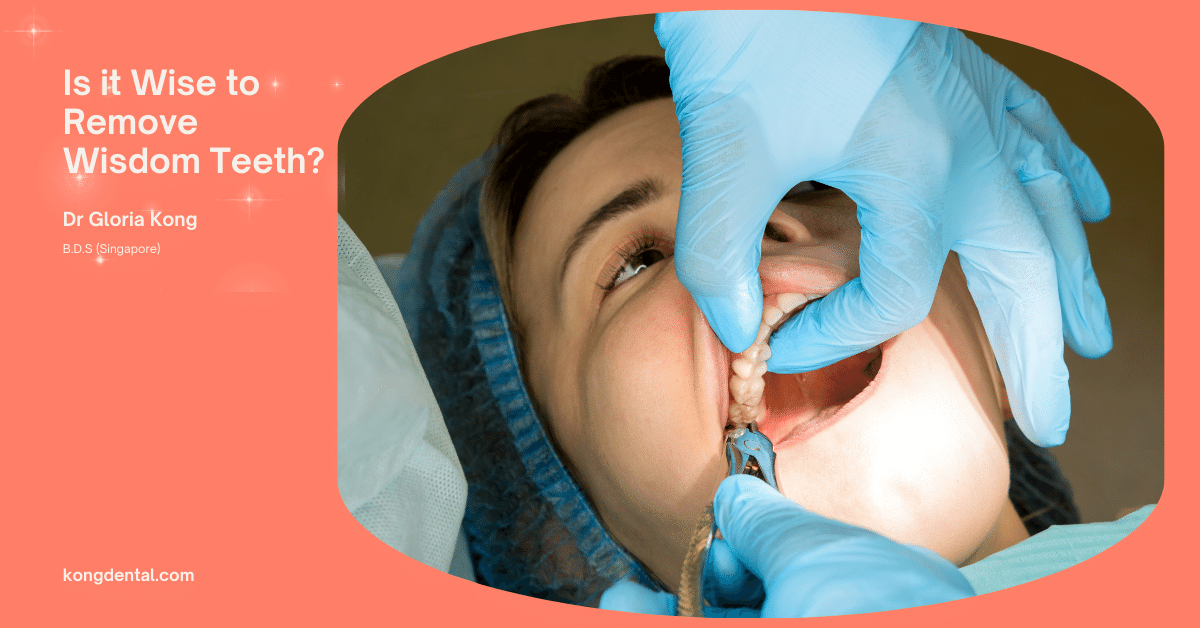 Is It Wise To Remove Wisdom Teeth - Kong Dental Surgery