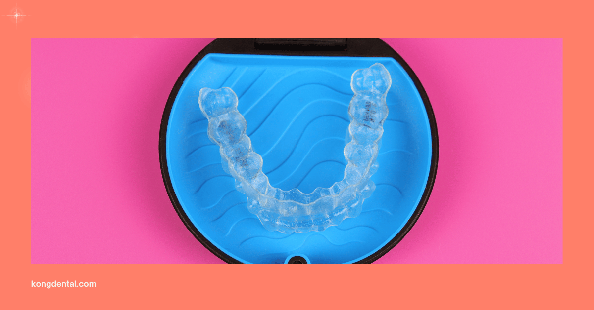 Invisalign Clear Aligners - Kong Dental Surgery