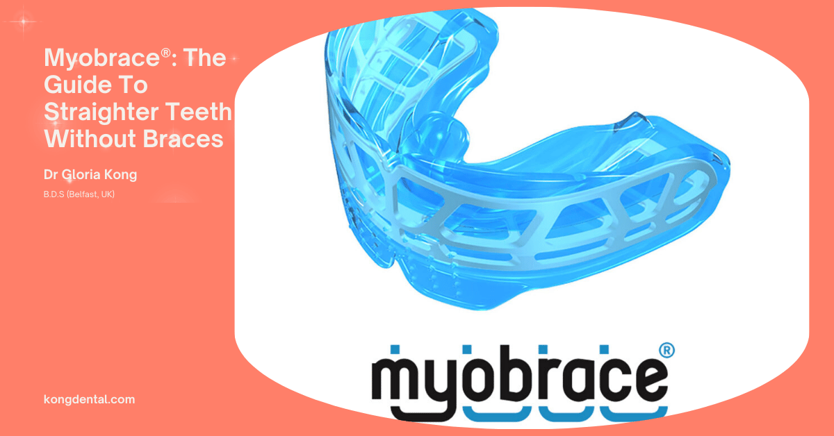 Myobrace®: The Guide To Straighter Teeth Without Braces - Kong Dental Surgery